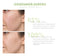 Farmhouse Fresh Comeback Clear Rapid Relief Acne Kit-shopbody.com